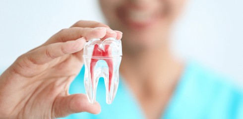 endodontie au Cabinet Dentaire Smile Boissiere paris 16