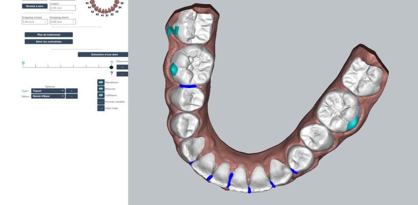 Logiciel de planification des traitements orthodontiques du Cabinet Dentaire Boissiere à Paris 16