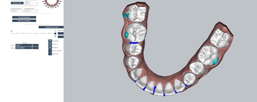 Logiciel de planification des traitements orthodontiques